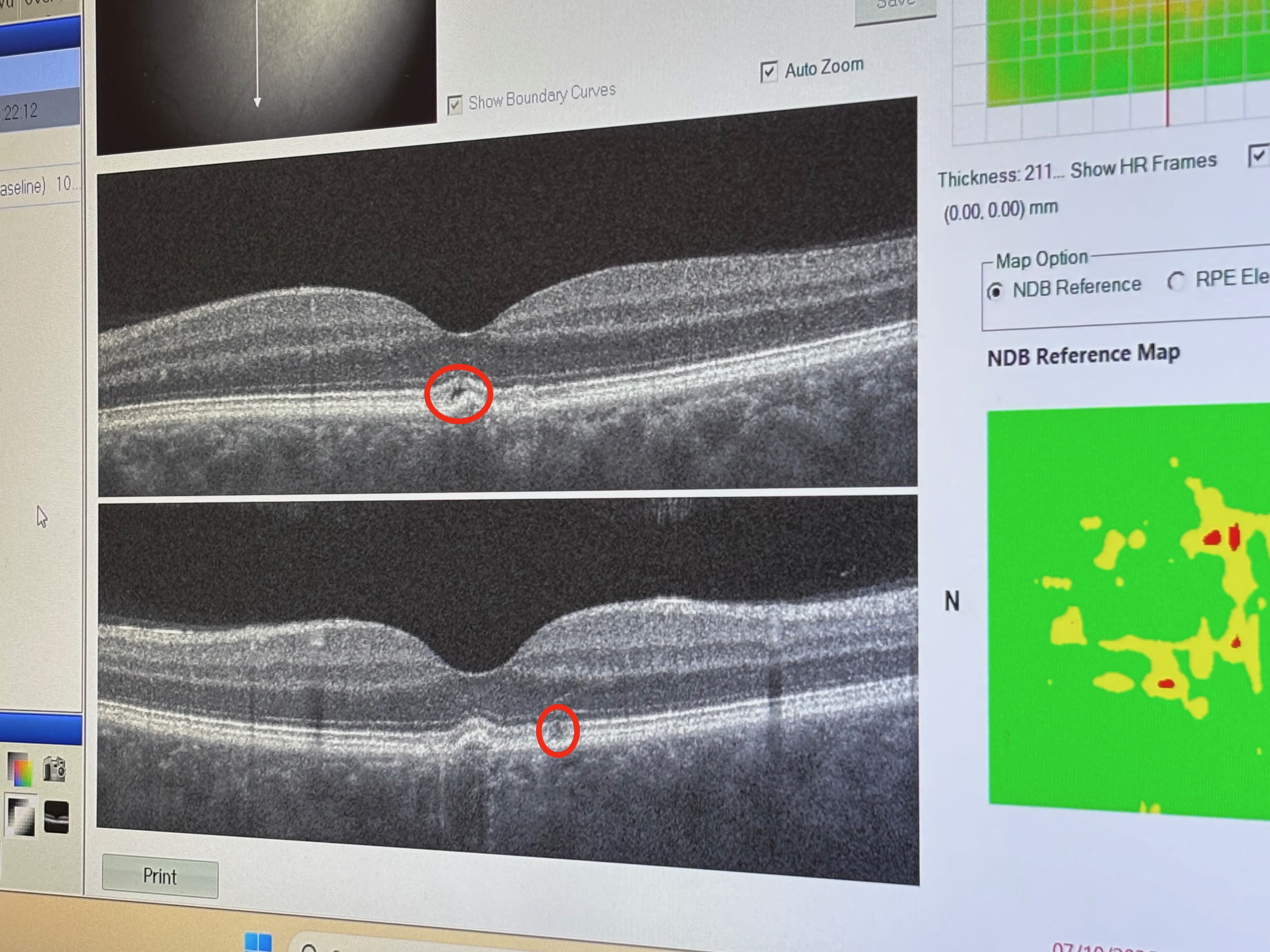 Retinal scan